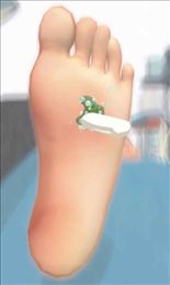 老板修个脚甲沟炎(FootClinic)
