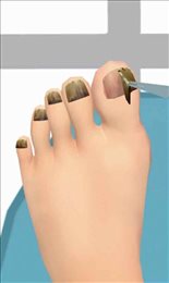 老板修个脚甲沟炎(FootClinic)